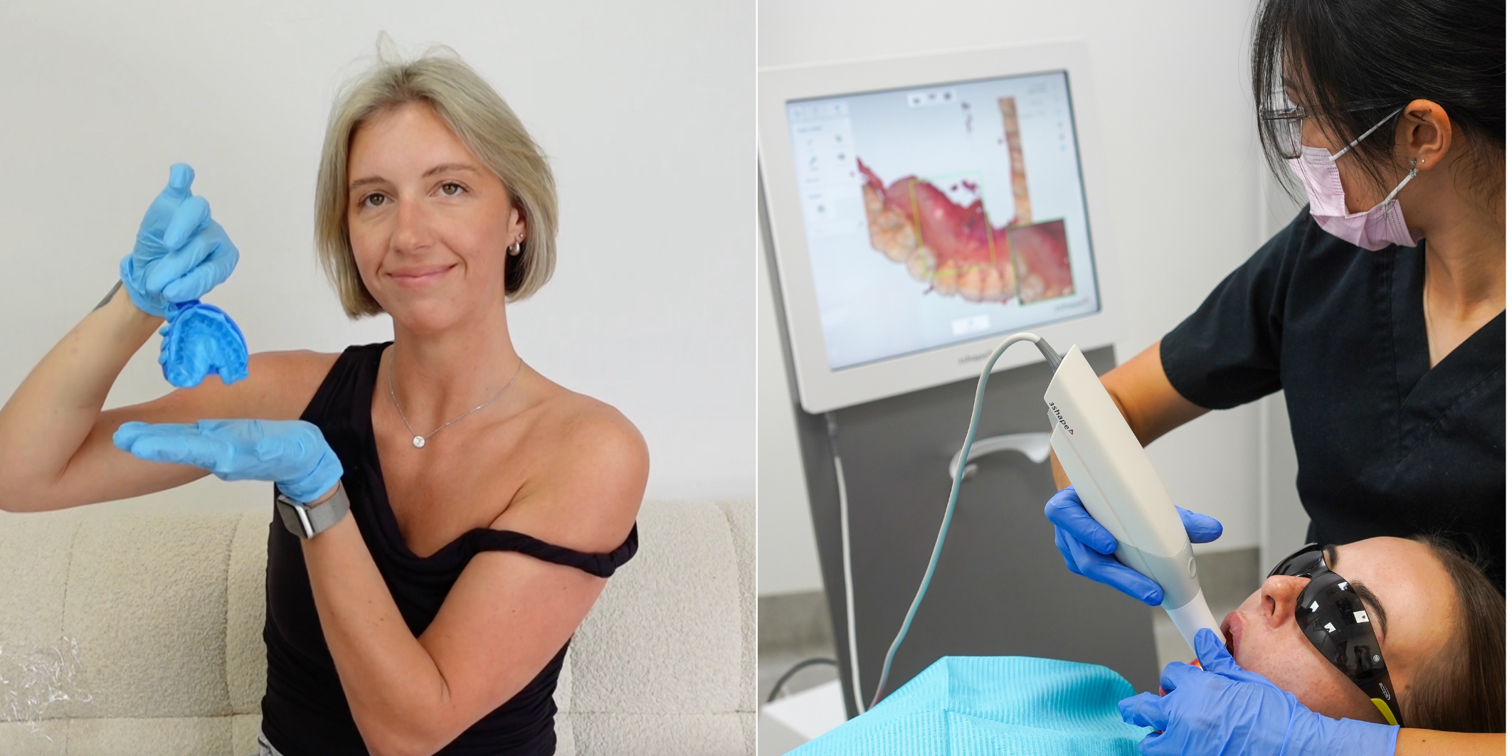 At-Home Clear Aligners vs In-Clinic Treatment