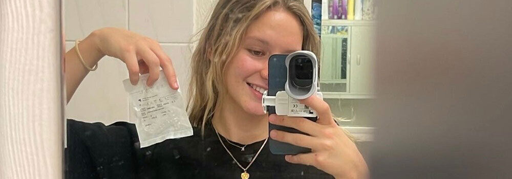 From Aligners to Allure: Embracing Blissful Smiles With Bitesoft Co