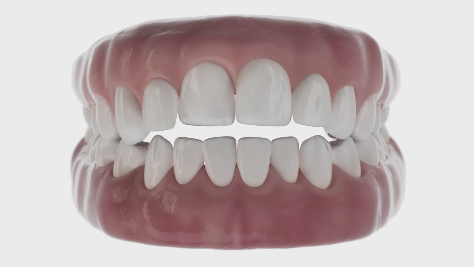 Load video: Open Bite - Video